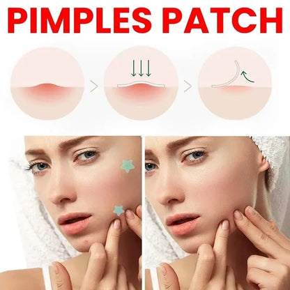 Clear Skin Magic Pimple Patches