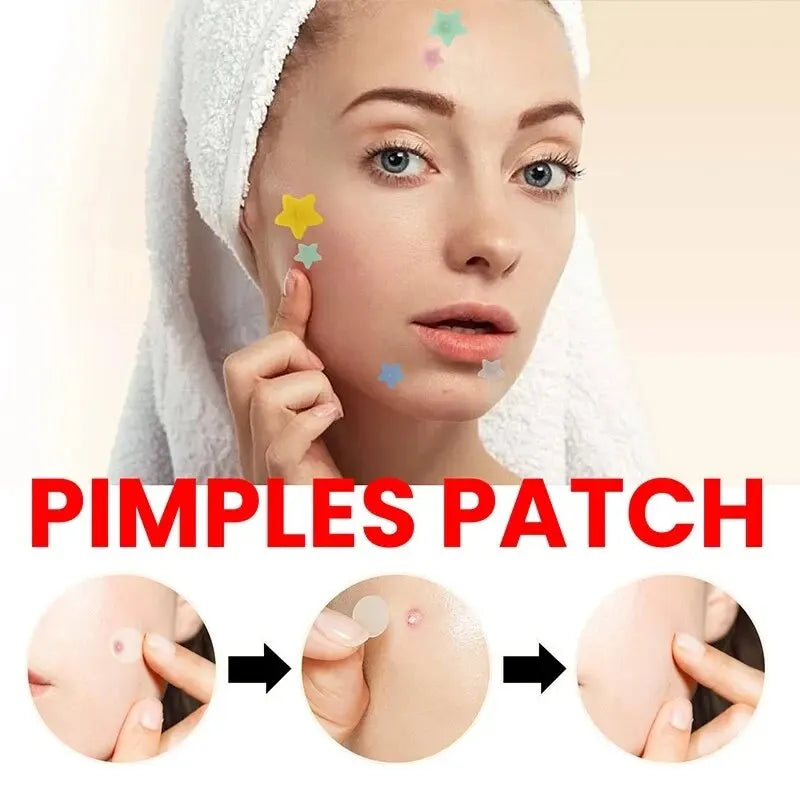 Clear Skin Magic Pimple Patches