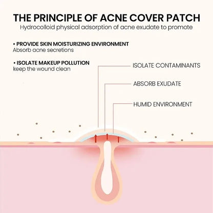 Clear Skin Magic Pimple Patches